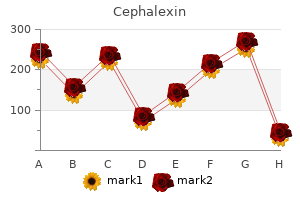 cheap cephalexin 250 mg without prescription