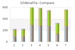 sildenafila 50 mg online