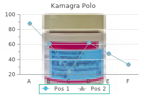buy kamagra polo 100 mg with visa
